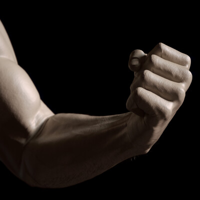 Arm
