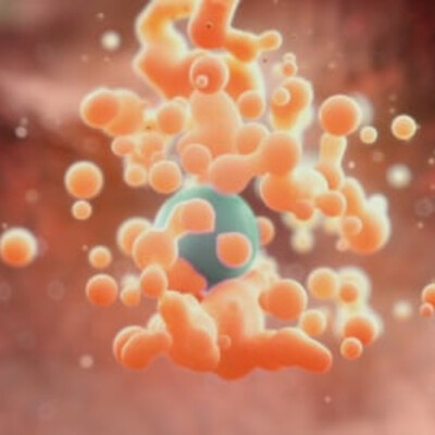 Medical visualization